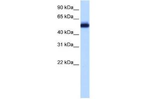 WB Suggested Anti-ZNF545 Antibody Titration:  0. (Zinc finger protein 82 homolog (ZFP82) (C-Term) 抗体)