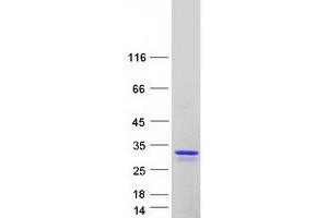 Western Blotting (WB) image for Transcription Factor 21 (TCF21) (Transcript Variant 1) protein (Myc-DYKDDDDK Tag) (ABIN2733354)