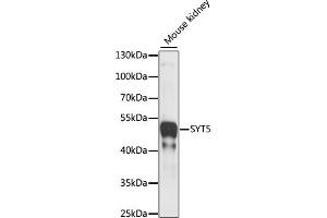 Western blot analysis of extracts of Mouse kidney, using SYT5 antibody (ABIN7270676) at 1:1000 dilution. (Synaptotagmin V 抗体  (AA 1-110))