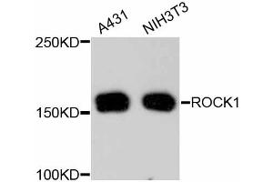 Western blot analysis of extracts of various cell lines, using ROCK1 antibody (ABIN4905028). (ROCK1 抗体)