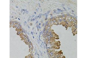 Immunohistochemistry (Paraffin-embedded Sections) (IHC (p)) image for anti-Transient Receptor Potential Cation Channel, Subfamily A, Member 1 (TRPA1) antibody (ABIN7264621)