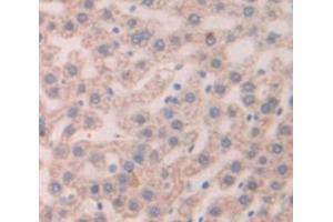 Figure. (Thymic Stromal Lymphopoietin 抗体  (AA 75-196))