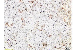 Formalin-fixed and paraffin embedded rat heart tissue labeled Anti-CTGF Polyclonal Antibody, Unconjugated (ABIN672636) at 1:200, followed by conjugation to the secondary antibody and DAB staining (CTGF 抗体  (AA 221-349))
