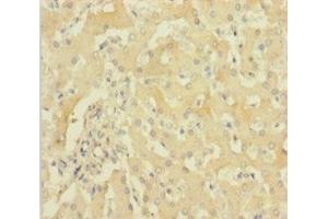 Immunohistochemistry of paraffin-embedded human liver tissue using ABIN7154984 at dilution of 1:100 (HBG1 抗体  (AA 2-147))
