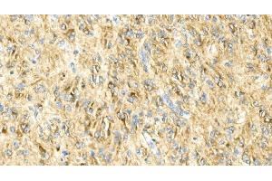 IHC analysis of GFAP using anti-GFAP antibody (ABIN7602675). (GFAP 抗体  (AA 93-432))