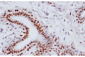 Immunohistochemistry (Paraffin-embedded Sections) (IHC (p)) image for anti-Histone 3 (H3) (acLys14), (acLys18), (acLys23), (acLys27), (acLys9) antibody (ABIN7259751)