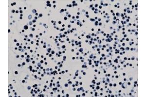 ICC testing of human HepG2 cells with recombinant H3K9ac antibody.