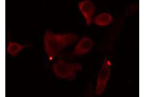 ABIN6274390 staining Hela cells by IF/ICC.