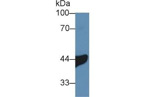 Detection of IL3Ra in Human A549 cell lysate using Polyclonal Antibody to Interleukin 3 Receptor Alpha (IL3Ra) (IL3RA 抗体  (AA 167-331))