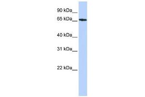 SDCCAG8 antibody used at 1 ug/ml to detect target protein. (SDCCAG8 抗体  (Middle Region))