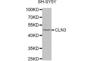 Western blot analysis of extracts of SH-SY5Y cell line, using CLN3 antibody. (CLN3 抗体  (AA 1-280))