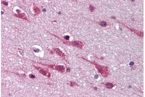 Human Brain, Cortex (formalin-fixed, paraffin-embedded) stained with MAPK9 antibody ABIN292321 at 20 ug/ml followed by biotinylated goat anti-rabbit IgG secondary antibody ABIN481713, alkaline phosphatase-streptavidin and chromogen.