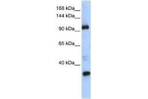 WB Suggested Anti-TUT1 Antibody Titration:  0. (TUT1 抗体  (Middle Region))