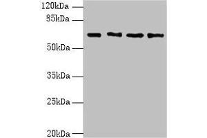 Western blot All lanes: ENC1 antibody at 5 μg/mL Lane 1: MCF-7 whole cell lysate Lane 2: HepG2 whole cell lysate Lane 3: Mouse brain tissue Lane 4: A549 whole cell lysate Secondary Goat polyclonal to rabbit IgG at 1/10000 dilution Predicted band size: 67, 58 kDa Observed band size: 67 kDa (ENC1 抗体  (AA 1-230))