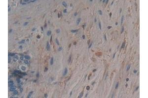 Immunohistochemistry (IHC) image for anti-Adenylyl Cyclase Associated Protein 2 (CAP2) (AA 1-477) antibody (ABIN7443644)