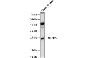 Western blot analysis of extracts of mouse thymus, using IP5 antibody (ABIN7265499) at 1:1000 dilution.