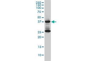 DNAJB6 Antikörper  (AA 1-241)