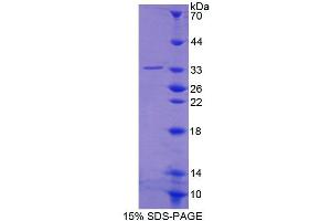 SDS-PAGE analysis of Human SPIN1 Protein.