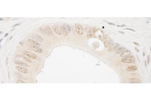 Immunohistochemistry (IHC) image for anti-RAD54-Like 2 (RAD54L2) (AA 75-125) antibody (ABIN7453659)