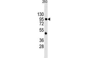 Image no. 1 for anti-Cadherin 1, Type 1, E-Cadherin (Epithelial) (CDH1) (N-Term) antibody (ABIN356994)