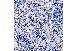 Immunohistochemistry of paraffin embedded mouse spleen using TREML1 (ABIN7076009) at dilution of 1:2200 (400x lens) (TREML1 抗体)