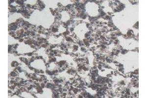 Detection of IL6 in Rat Lung Tissue using Monoclonal Antibody to Interleukin 6 (IL6) (IL-6 抗体  (AA 25-211))