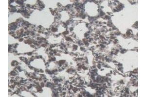 Detection of IL6 in Rat Lung Tissue using Monoclonal Antibody to Interleukin 6 (IL6) (IL-6 抗体  (AA 25-211))