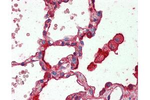 Anti-SFTPA1 / Surfactant Protein A antibody IHC staining of human lung. (Surfactant Protein A1 抗体)