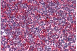 Human Tonsil: Formalin-Fixed, Paraffin-Embedded (FFPE) (EFHD2 抗体  (N-Term))