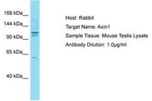 Image no. 1 for anti-Axin 1 (AXIN1) (AA 8-62) antibody (ABIN6750309) (Axin 抗体  (AA 8-62))