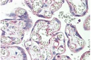 Human Placenta: Formalin-Fixed, Paraffin-Embedded (FFPE) (PSG3 抗体  (AA 22-50))