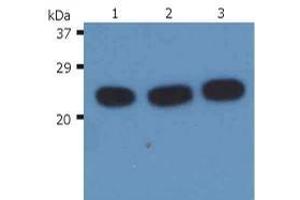 Western Blotting (WB) image for anti-HRas proto-oncogene, GTPase (HRAS) antibody (ABIN238418) (HRAS 抗体)