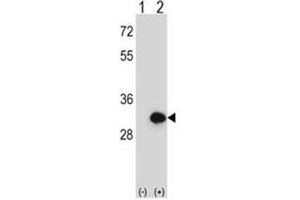 Western blot analysis of BPGM (arrow) using rabbit polyclonal BPGM Antibody (C-term) . (BPGM 抗体  (C-Term))