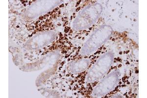 IHC-P Image PACAP antibody [N1C3] detects PACAP protein at cytosol on human normal colon mucosa with lymphocyte by immunohistochemical analysis.