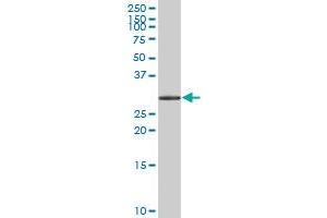 HSD17B6 MaxPab polyclonal antibody. (HSD17B6 抗体  (AA 1-317))