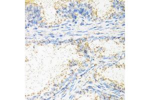 Immunohistochemistry of paraffin-embedded human prostate using NTF4 antibody at dilution of 1:100 (40x lens). (Neurotrophin 4 抗体)