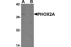 Western blot analysis of PHOX2A in rat brain tissue lysate with PHOX2A antibody at 1 µg/mL in (A) the absence and (B) the presence of blocking peptide. (PHOX2A 抗体  (C-Term))