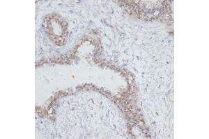 Immunohistochemistry of paraffin-embedded human breast using NOL3 antibody. (NOL3 抗体  (AA 1-208))