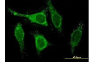 Immunofluorescence of monoclonal antibody to CSEN on HeLa cell.