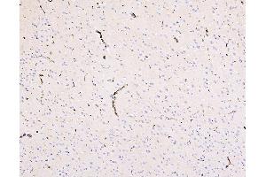 IHC analysis of SLC2A1 using anti-SLC2A1 antibody (ABIN3043927).