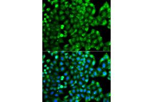 Immunofluorescence analysis of A549 cells using HLA-DRB1 antibody (ABIN5975721). (HLA-DRB1 抗体)