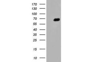 HEK293T cells were transfected with the pCMV6-ENTRY control (Left lane) or pCMV6-ENTRY AFP (Right lane) cDNA for 48 hrs and lysed. (alpha Fetoprotein 抗体)