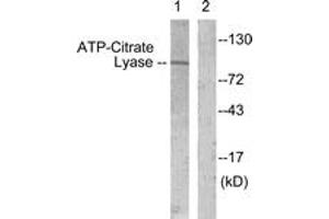 Western blot analysis of extracts from COS7 cells, treated with Calyculin 50nM 30', using ATP-Citrate Lyase (Ab-454) Antibody.