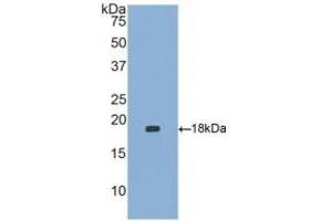 Detection of Recombinant HBEGF, Human using Polyclonal Antibody to Heparin Binding Epidermal Growth Factor Like Growth Factor (HBEGF) (HBEGF 抗体  (AA 21-160))