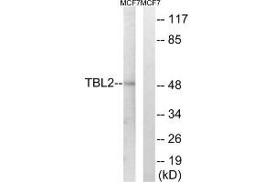Western blot analysis of extracts from MCF-7 cells, using TBL2 antibody. (TBL2 抗体  (C-Term))