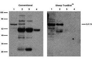 Sheep IP / Western Blot Sheep IP / Western Blot: Jurkat cell lysate (500 µg) was incubated with 2 µg of sheep anti-SLP76 and immunoprecipitated using Protein G. (绵羊 TrueBlot® Anti-绵羊 IgG HRP)