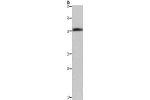 Gel: 6 % SDS-PAGE, Lysate: 40 μg, Lane: Human fetal liver tissue, Primary antibody: ABIN7129455(FAR2 Antibody) at dilution 1/1000, Secondary antibody: Goat anti rabbit IgG at 1/8000 dilution, Exposure time: 40 seconds (FAR2 抗体)