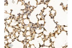 ABIN7094756 and ABIN7098807 at 1/100 staining Mouse lung tissue by IHC-P. (MED16 抗体  (Internal Region))