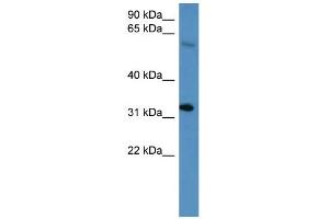 WB Suggested Anti-Hoxd13 Antibody Titration: 0. (Homeobox D13 抗体  (C-Term))