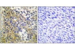 Immunohistochemistry (IHC) image for anti-Collagen, Type IV, alpha 6 (COL4a6) (AA 1201-1250) antibody (ABIN2889915) (COL4a6 抗体  (AA 1201-1250))